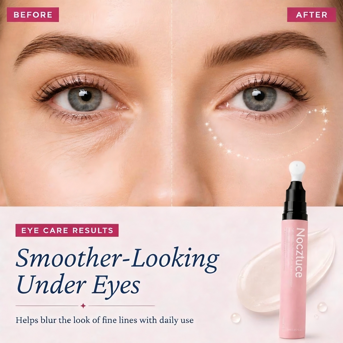 Nocztuce IceGlow Cooling Eye Serum Pen – Ceramic Tip Hydrating Eye Treatment