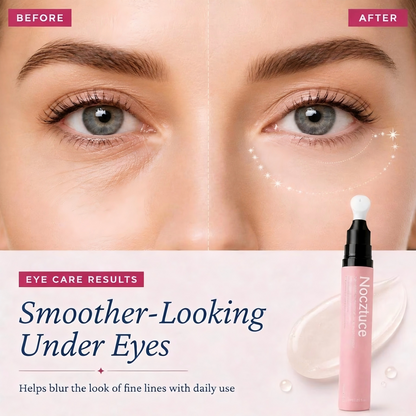 Nocztuce IceGlow Cooling Eye Serum Pen – Ceramic Tip Hydrating Eye Treatment